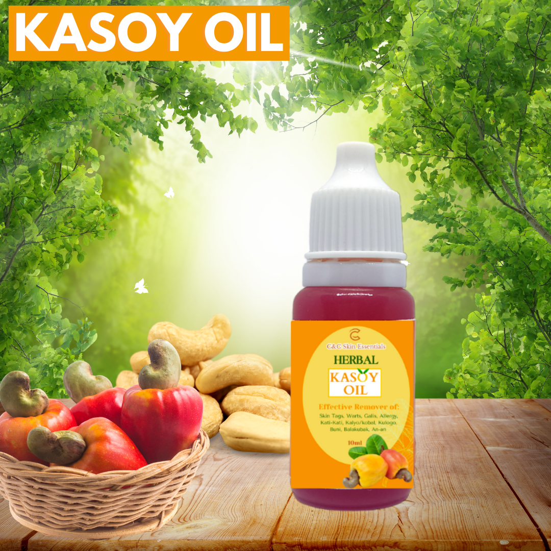 Kasoy Oil Effective Warts and Mole Remover 10ml