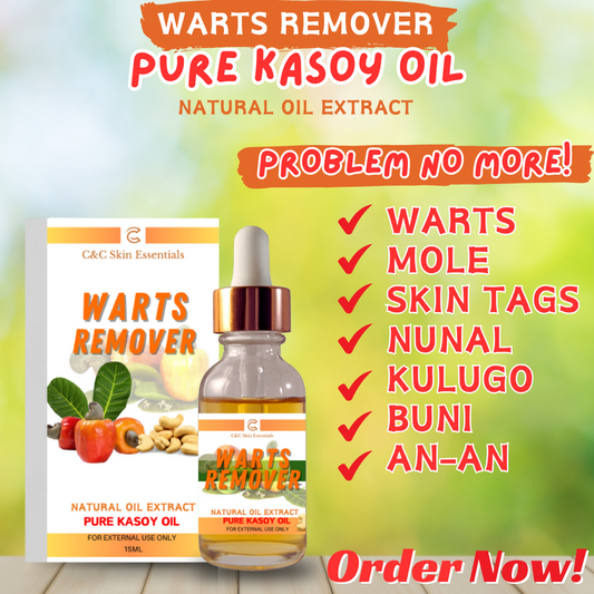 Original Pure Kasoy Oil Warts Remover: Effective for Painless Removal of Skin Tags, Moles, Kulugo, Buni, and An-An