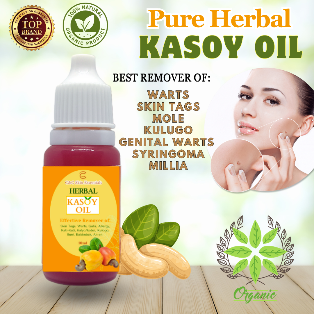 Kasoy Oil Effective Warts and Mole Remover 10ml